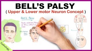 Bells palsy Upper and Lower Motor Neuron Lesions  Simplified [upl. by Blondie]