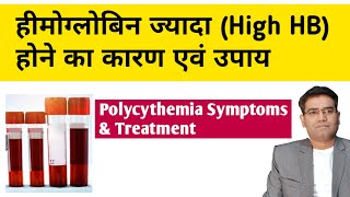 High hemoglobin Polycythemia Causes Symptoms Investigation and Treatment in Hindi [upl. by Ardnasal]