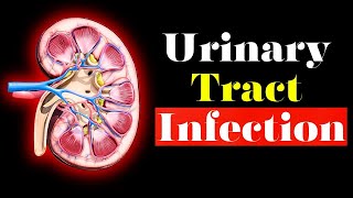 Urinary Tract Infection  Overview signs and symptoms pathophysiology causes and treatment [upl. by Shepley]