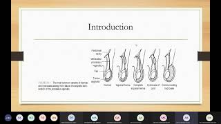 Pediatric Inguinoscrotal Disorders  Dr Ahmad Barakat [upl. by Ranjiv759]