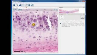 Module 2 Hyaline Cartilage [upl. by Haret]