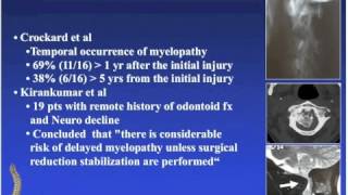 Spine Odontoid Fractures Overview and Surgical Treatment [upl. by Nehcterg]