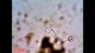 Vorticella Reproduction [upl. by Rimaj335]