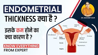 Endometrial thickness Cancer in Hindi Layers ThinEndometrial Hyperplasia Causes Treatment [upl. by Avik]