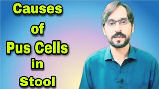 Pus Cells in Stool  Causes of Pus Cells in Stool [upl. by Lalad]