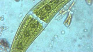 ALGA CLOSTERIUM ENTRE DIATOMS [upl. by Annaik522]