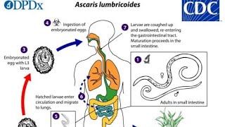 Ascaris lumbricoides habitat mode of infection pathogenecity lab diagnosis and prevention [upl. by Lupe]