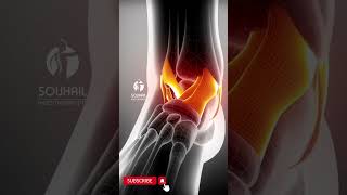 Ankle eversion sprain sprain physicaltherapy anatomyphysiology movement shorts ankle [upl. by Witherspoon]