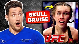 Doctor Reacts To Painful UFC MMA Injuries [upl. by Harleigh]