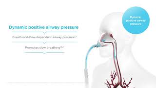 How does Optiflow High Flow work Mechanisms of action – Dynamic positive airway pressure [upl. by Kubis945]