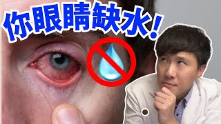 這10種人眼睛嚴重缺水 缺水型乾眼症一次看懂 [upl. by Nylessej802]