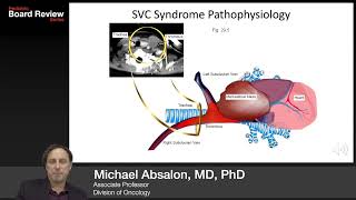 Oncology  Oncologic Emergencies 2019 Board Review Series [upl. by Sturrock]