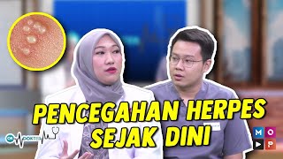 OK DOKTER PENCEGAHAN SAAT TERKENA HERPES SEJAK DINI AGAR TIDAK MENYESAL [upl. by Dhumma]