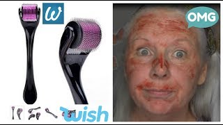 How NOT To Use A Derma Roller Graphic Please read description [upl. by Suoicerp]