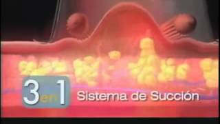 Perricone MDs 1 Iconic Cold Plasma Plus SubDNeck Treatment Is Now Better Than Ever [upl. by Sil213]