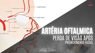 Artéria oftálmica e perda de visão após preenchimento facial [upl. by Inajna]