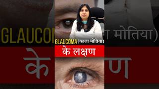 काला मोतियाबिंद Glaucoma के लक्षण [upl. by Eetse]