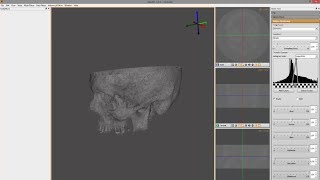 Preparing DICOM images CTMRT for 3d printing STL [upl. by Brenton285]