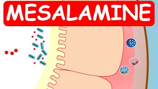 Mesalamine Pentasa ER capsules for ulcerative colitis [upl. by Ttennaej]