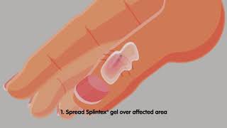 How Magnoplasm Splintex Works  Painfree fussfree splinter removal [upl. by Lally934]