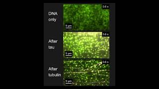 Tau microtubule binding to DNA [upl. by Fang500]