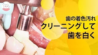 黄ばんだ歯を綺麗にするには歯のクリーニングを How To Remove Yellow Stains From Teeth [upl. by Ocire144]