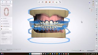 Ivotion Monolithic Denture Design [upl. by Couchman]