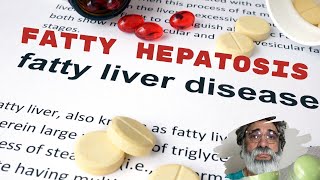 Understanding Fatty Liver Disease Hepatic Steatosis [upl. by Nodnrb]