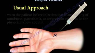 Carpal Tunnel Injection  Everything You Need To Know  Dr Nabil Ebraheim [upl. by Faubert316]