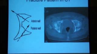 12 Radiological diagnosis of the acetabulum H Abdel Azeem [upl. by Pournaras275]