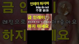 인레이 하지마 인레이하면 잘 떨어지니 레진하세요 인레이탈락했다고 크라운하면 과잉진료 DentiTube20230908 [upl. by Maupin326]