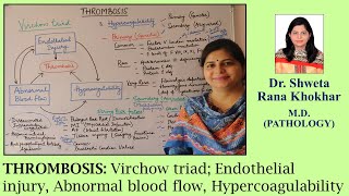 THROMBOSIS Virchow triad Endothelial injury Abnormal blood flow Hypercoagulability [upl. by Elbertine]