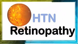 hypertensive retinopathy شرح [upl. by Eneloc629]