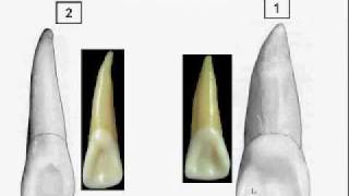 Dentition Identification121part1of3m4v [upl. by Iman]