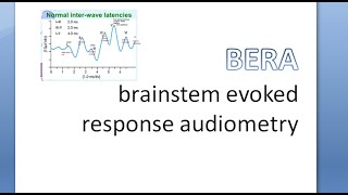 ENT ElectroCochleoGraphy and BERA Brainstem Evoked Response Audiometry [upl. by Einahpats]