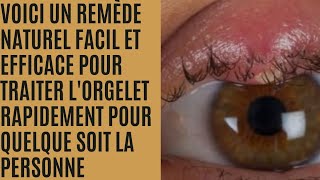 comment traiter un orgelet rapidement et naturellement [upl. by Ivonne]