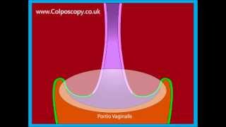 Anatomy of the cervix [upl. by Ennaitak]