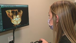 Dental experts warn against DIY braces TikTok trend [upl. by Svetlana677]