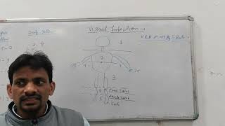 neonatal jaundice a case presentation part 1 [upl. by Dihgirb]