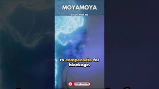 HealthByte Moyamoya  A medical minute [upl. by Halona]