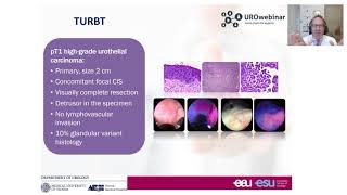 Urowebinar BCG unresponsive disease how this definition impact your treatment decision making [upl. by Mulderig]