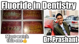 Fluoride in Dentistry [upl. by Nelyahs]