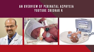 Perinatal asphyxia An overview of perinatal asphyxia Therapeutic hypothermia Dr Sridhar K [upl. by Cinderella671]