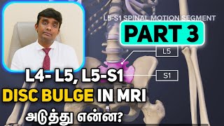 L4L5 and L5S1 Disc Bulge in MRI Whats Next Part 2 with Dr Vijayaraghavan in Tamil [upl. by Eehsar]