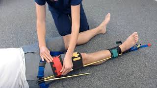 Traction Splint Application for use in Femur Fractures [upl. by Mannes]