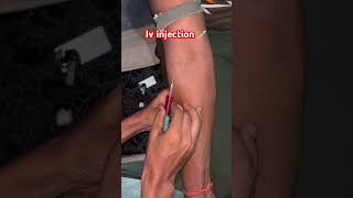 Iv injection viralvideo li [upl. by Bollay]