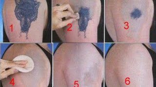 How to Remove a Tattoo without Laser at Home [upl. by Lusar741]