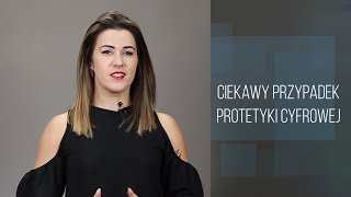 Cyfrowa Stomatologia  odc 6  Ciekawy przypadek protetyki cyfrowej [upl. by Greenlee862]