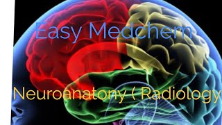 Introduction to Neuroanatomy Radiology [upl. by Labotsirhc]