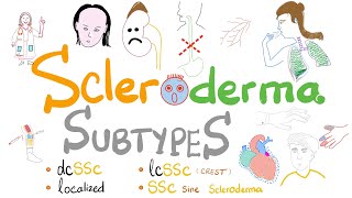 Scleroderma Subtypes 5 Types of Systemic Sclerosis incl Limited vs Diffuse Scleroderma [upl. by Yretsym342]